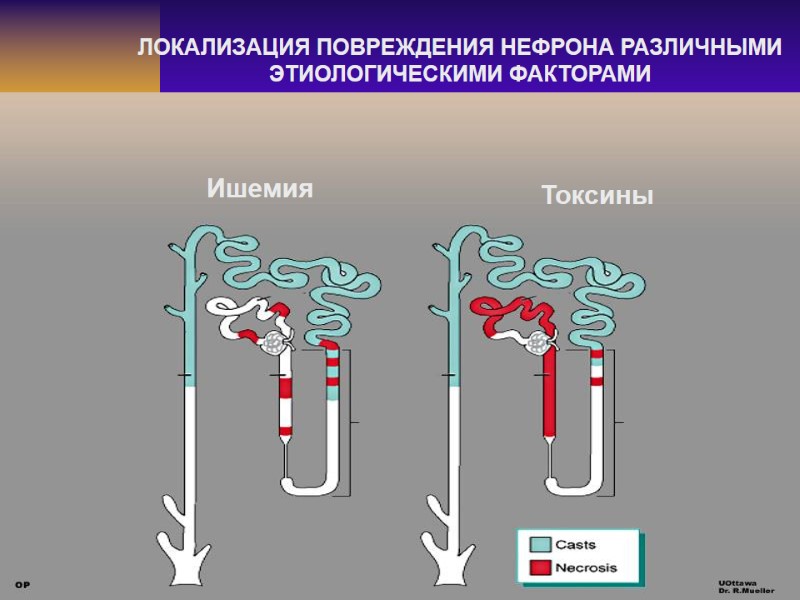ЛОКАЛИЗАЦИЯ ПОВРЕЖДЕНИЯ НЕФРОНА РАЗЛИЧНЫМИ ЭТИОЛОГИЧЕСКИМИ ФАКТОРАМИ Ишемия Токсины